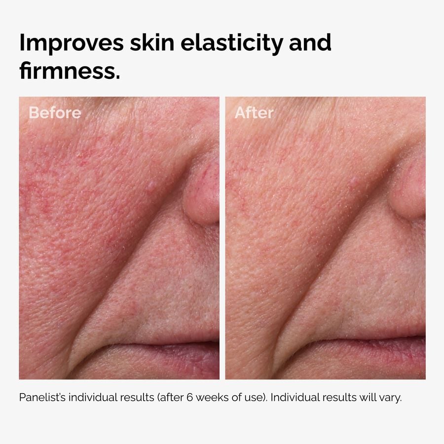 The Ordinary Face Oil - 100% Fermented Rose Hip Seed | Product Guide　XX