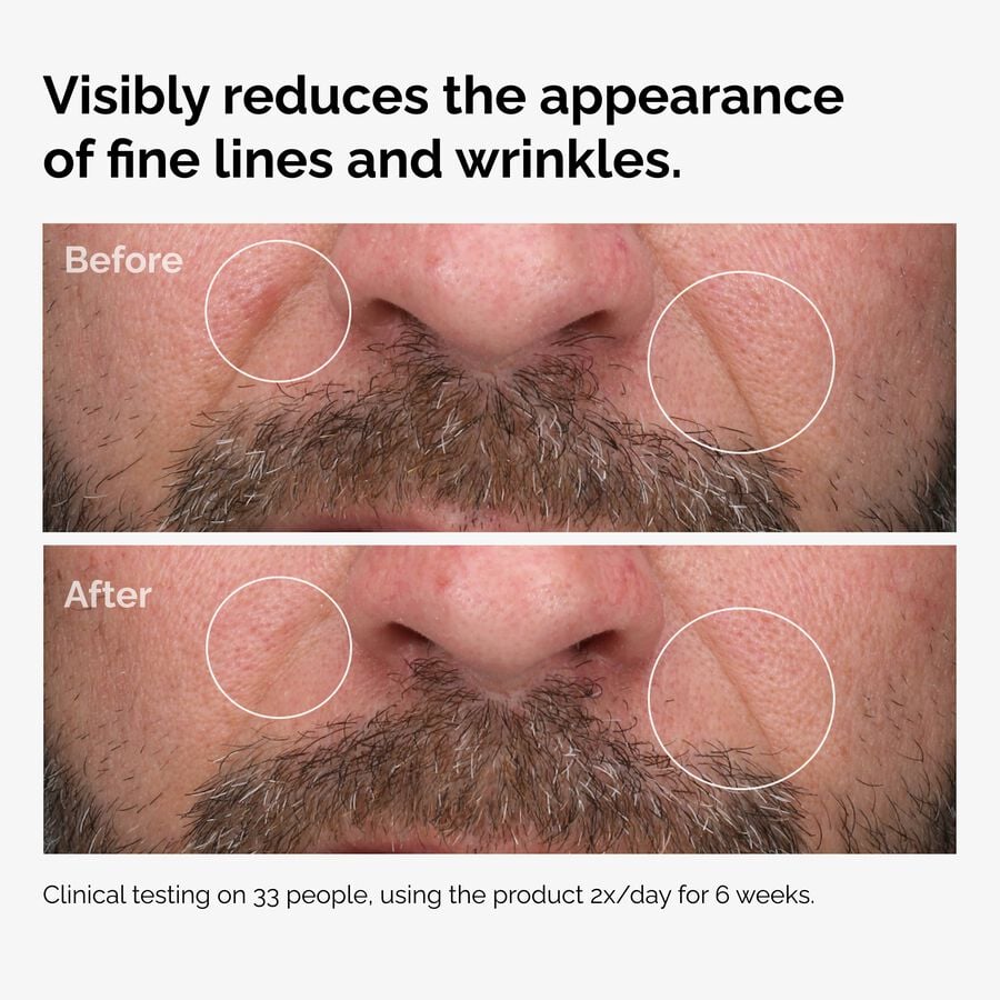 The Ordinary Face Oil - 100% Fermented Rose Hip Seed | Product Guide　XX