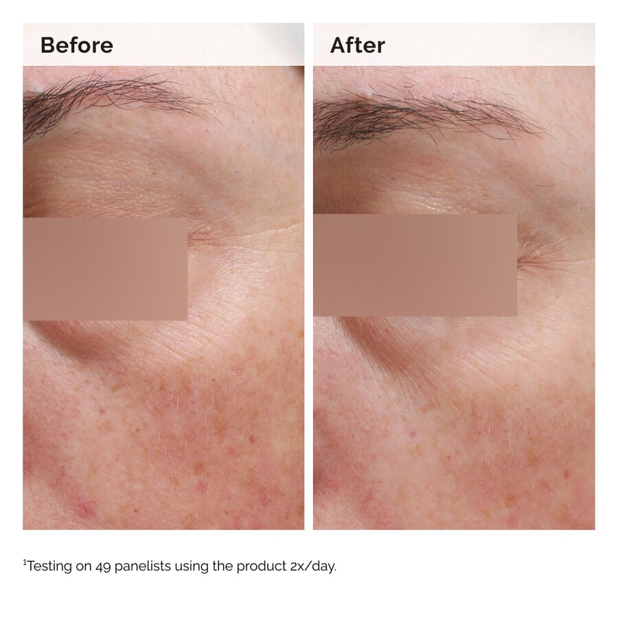 The Ordinary Face and Body Emulsion with Niacinamide 5% — Product Information　nP