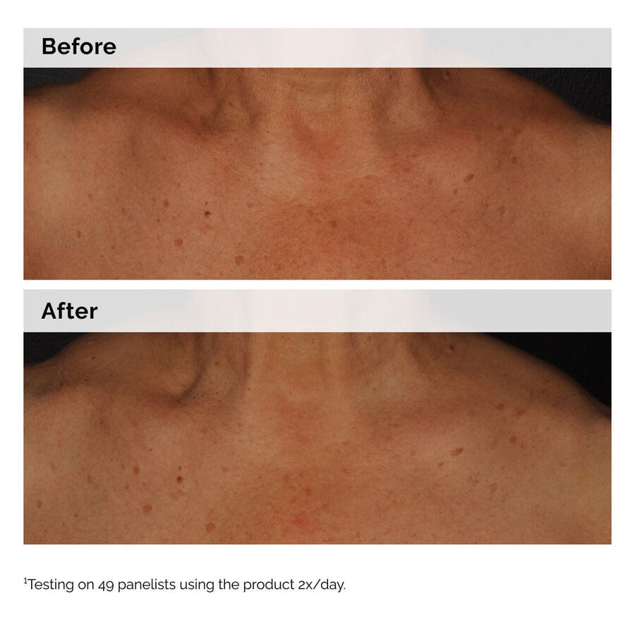 The Ordinary Face and Body Emulsion with Niacinamide 5% — Product Information　nP