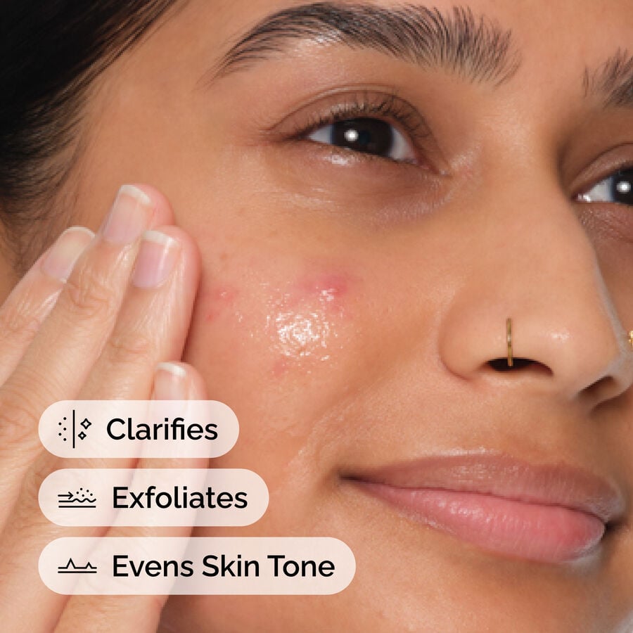 The Ordinary Exfoliating Treatment - Salicylic Acid 2% Anhydrous Solution — Item Information　VJ