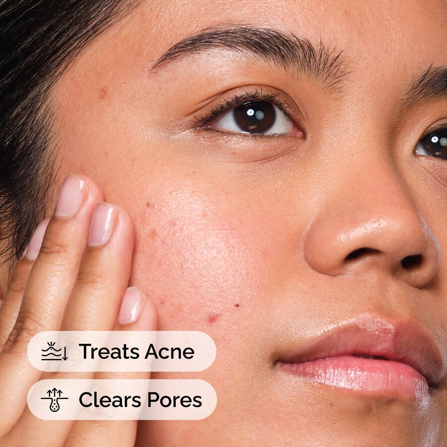 The Ordinary Exfoliating Treatment - Salicylic Acid 2% Solution — Product Facts　ip