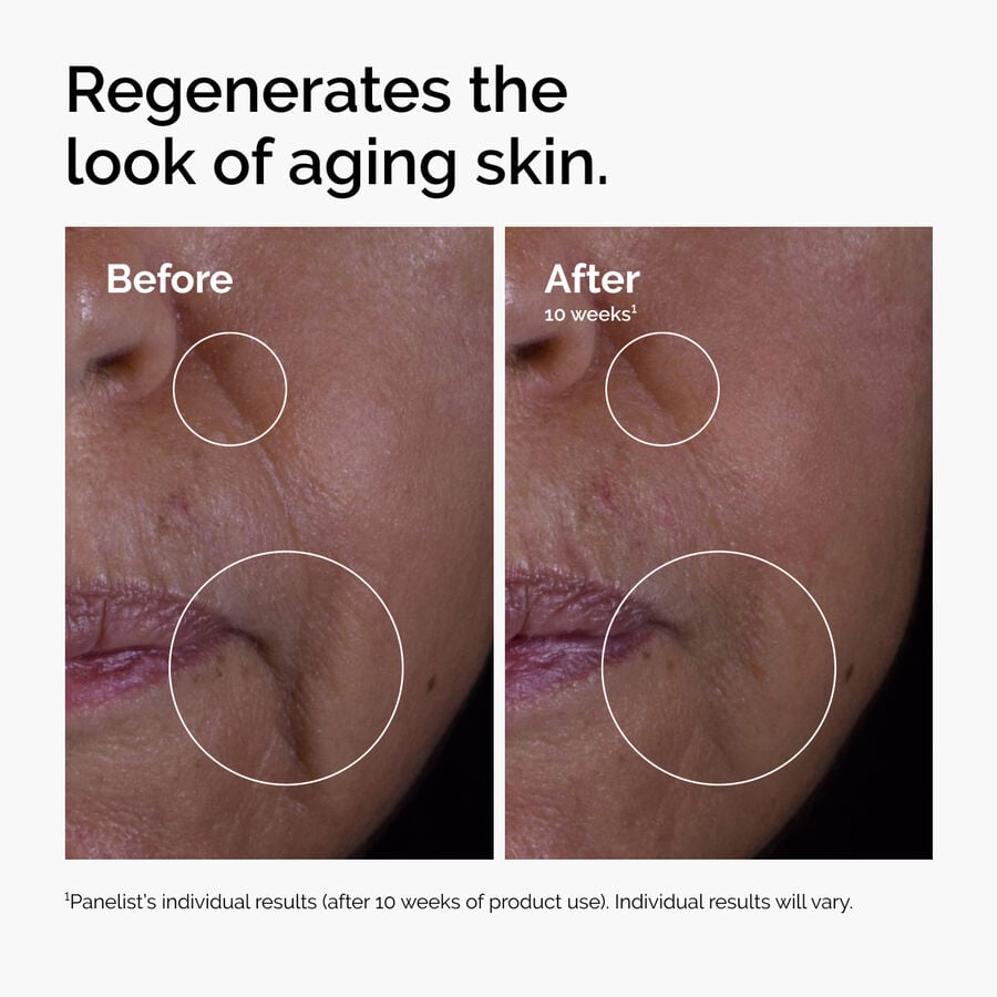 The Ordinary Treatment - GF 15% Solution | Product Features　bJ