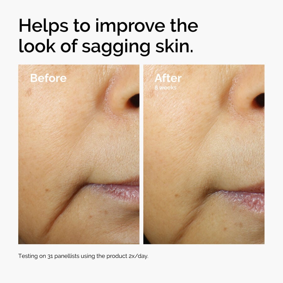 The Ordinary Energizing Face Serum with Caffeine 3% and Escin 1% | Detailed Overview　xo