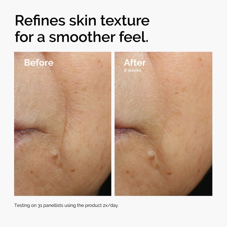 The Ordinary Energizing Face Serum with Caffeine 3% and Escin 1% | Detailed Overview　xo