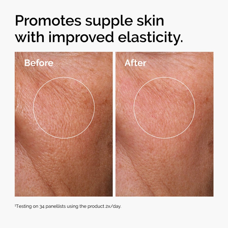 The Ordinary Treatment - Hyaluronic Acid 2% + B5 (with Ceramides) — Full Product Details　Z3
