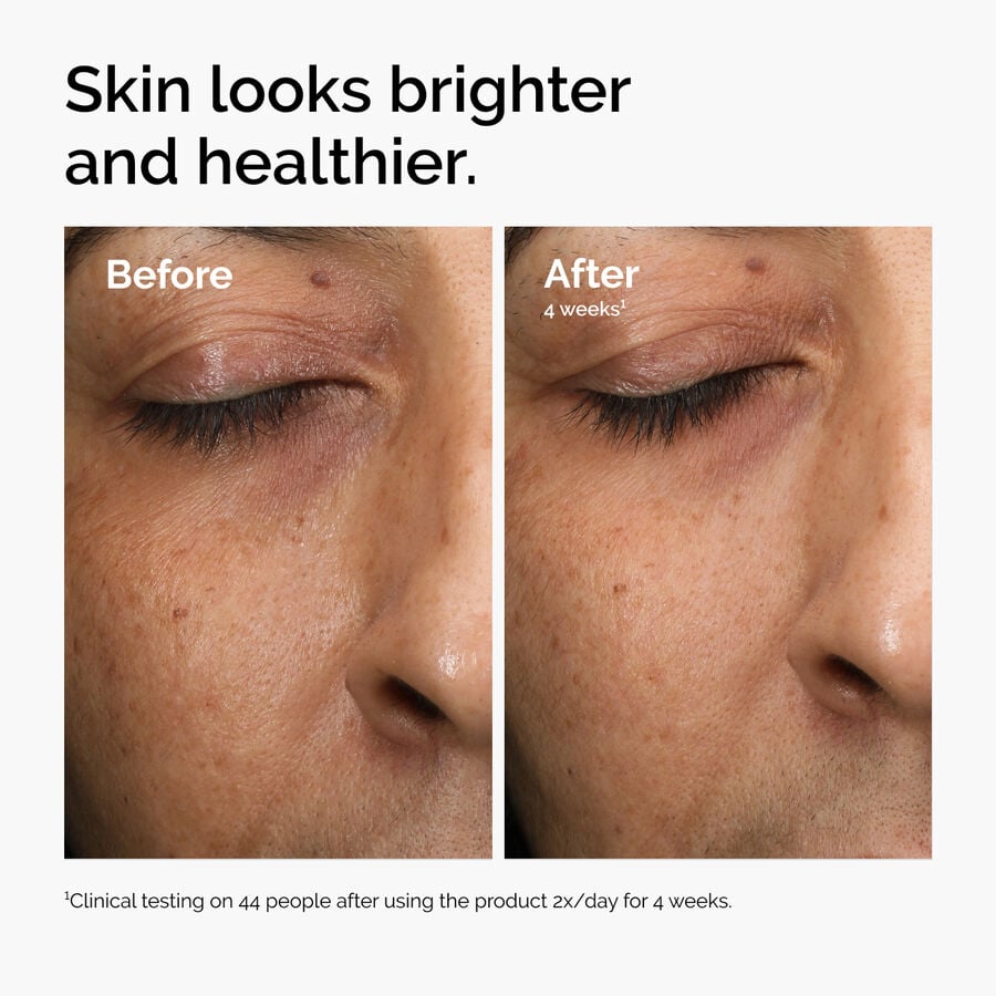 The Ordinary Treatment - Multi-Antioxidant Radiance Serum — Product Information　Bc
