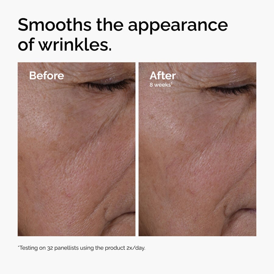 The Ordinary Treatment - Multi-Peptide + HA Serum — Product Details　fL