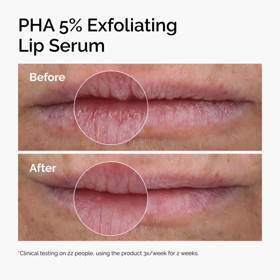 The Ordinary Lip Exfoliating Serum with PHA 5% — Item Information　7R