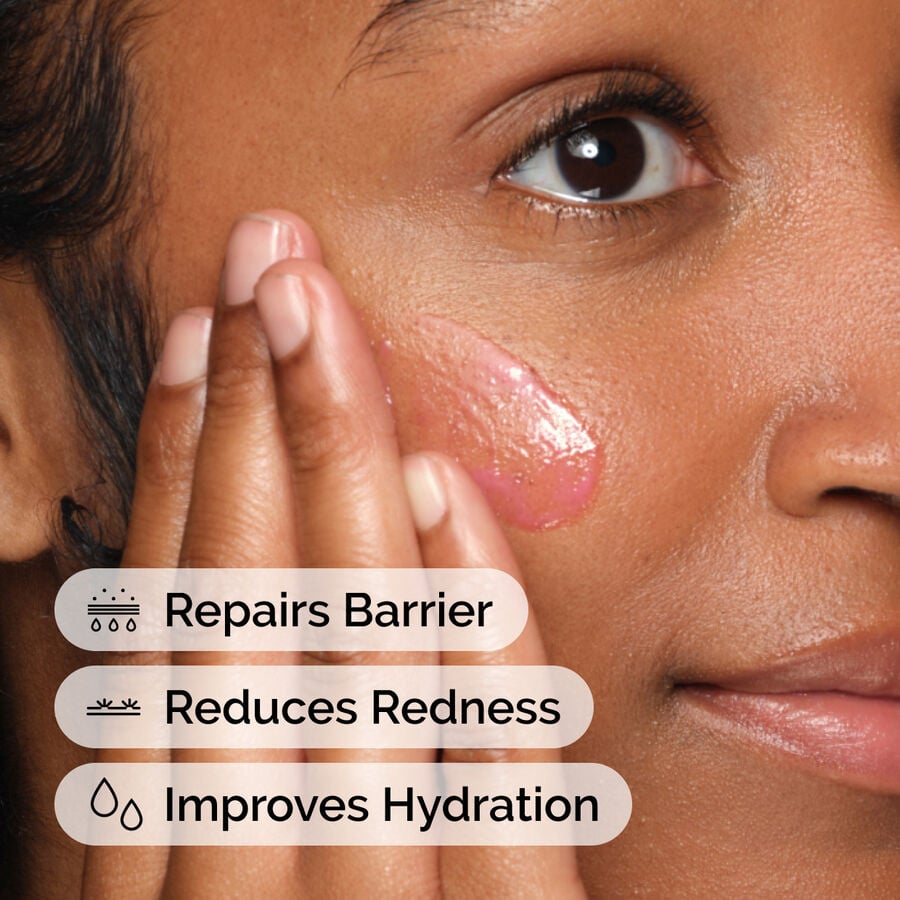 The Ordinary Treatment - Soothing & Barrier Support Serum | Product Features　IA