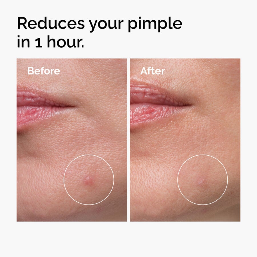 The Ordinary Sulfur 10% Powder-to-Cream Treatment — Full Product Details　9W